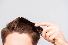 Top Hair Tools for Thinning Hair: Expert Reviews & Recommendations